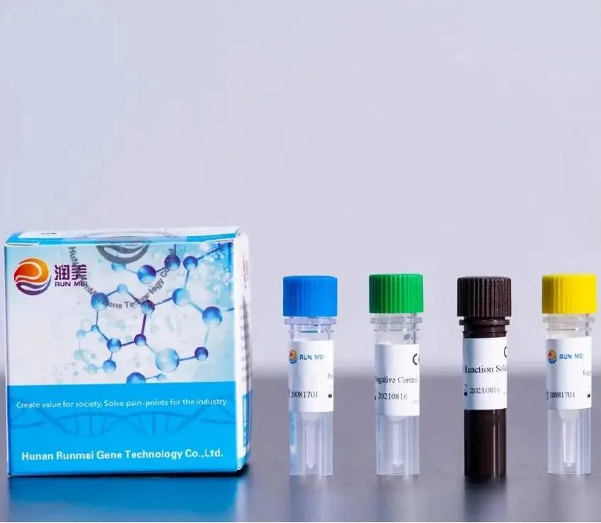 Mv Process Control Nucleic Acid Detection Kit (fluorescence PCR method)